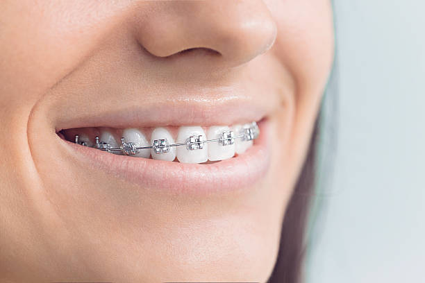 Best Veneers and Lumineers  in Morehead City, NC